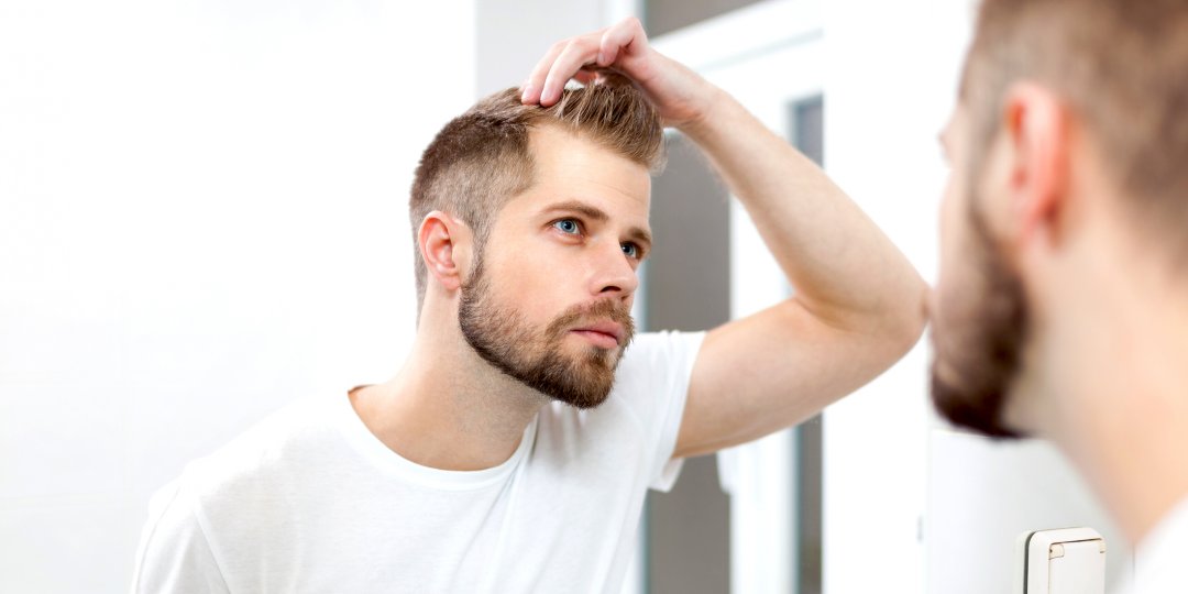 Is Hair Transplantation the Best Hair Loss Solution?